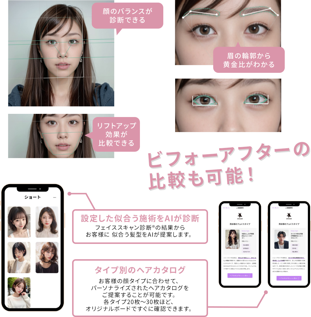 AI診断