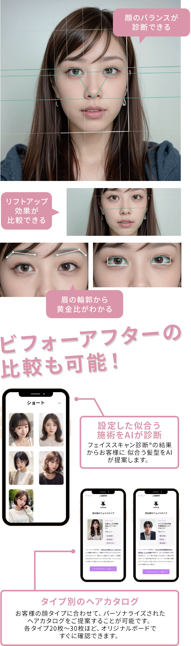 AI診断