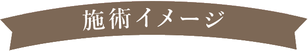施術イメージ